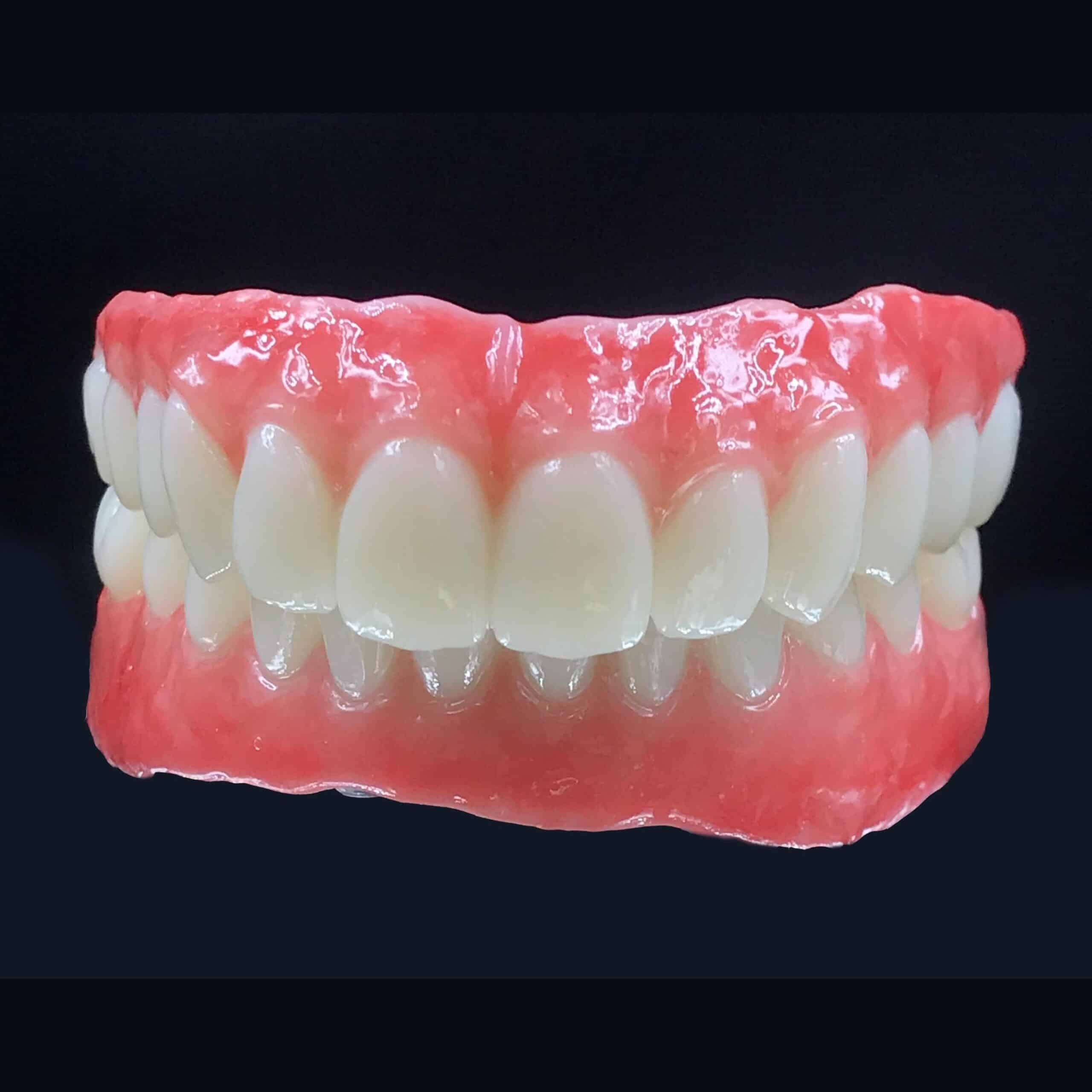 Backer Dental Lab case support