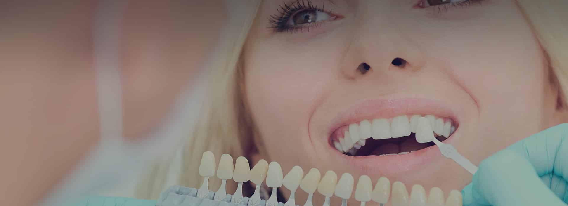 Backer Dental Lab dental restoration work